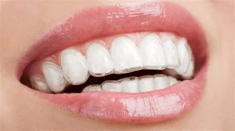 limpieza dental profesional